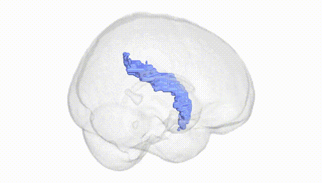 Full Brain White