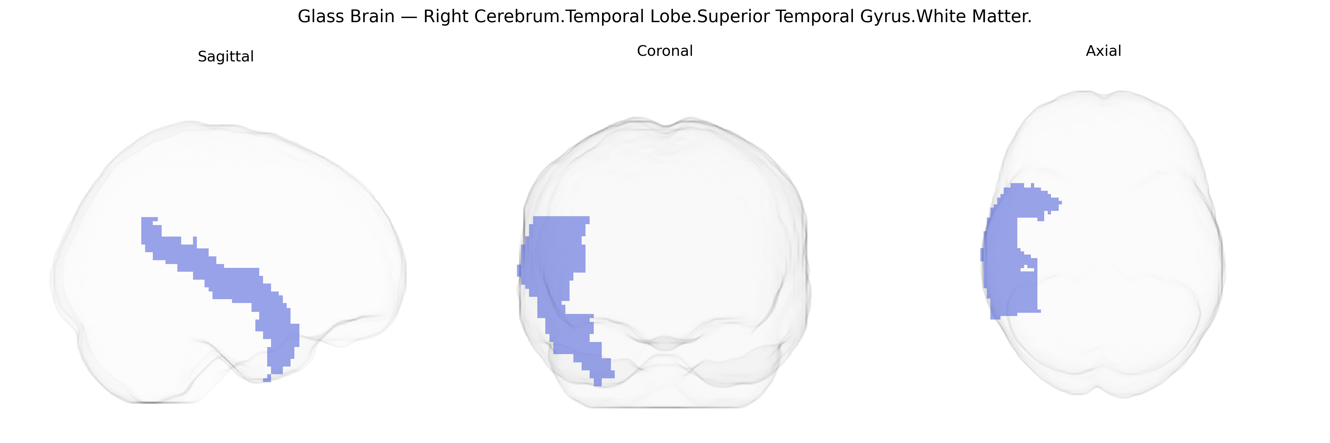 Triplanar Ghost Brain