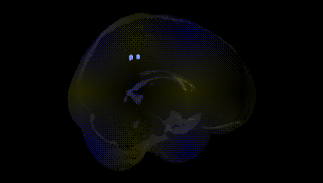 Full Brain Black