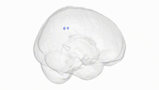 Full Brain White