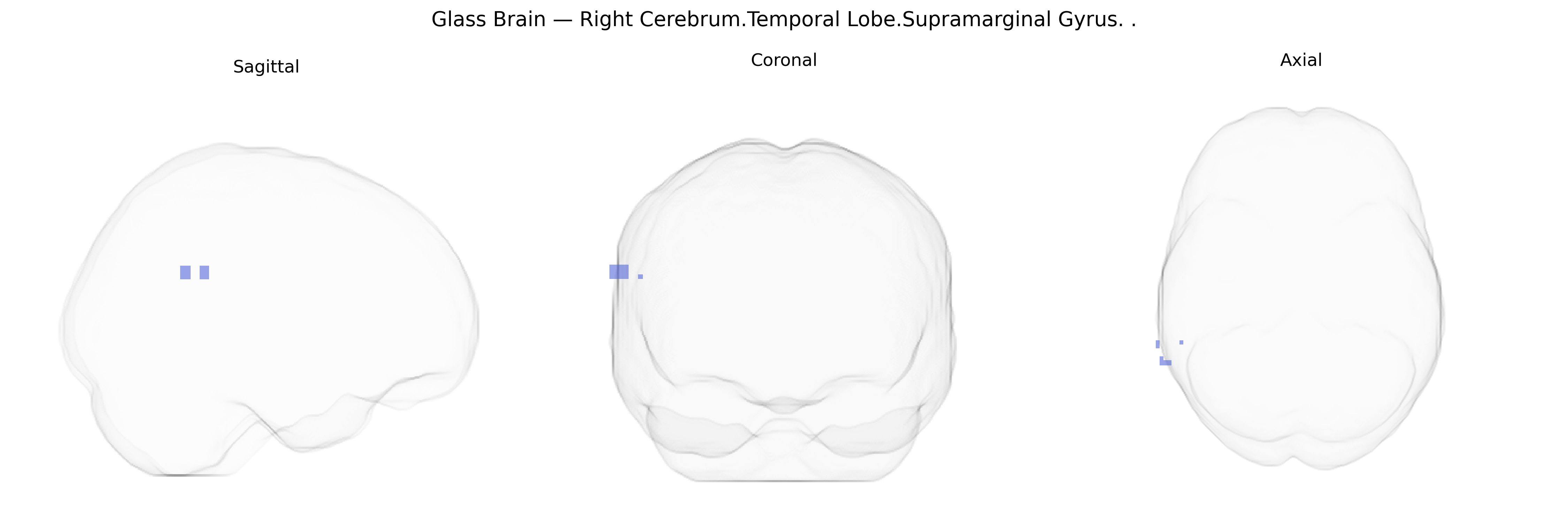 Triplanar Ghost Brain