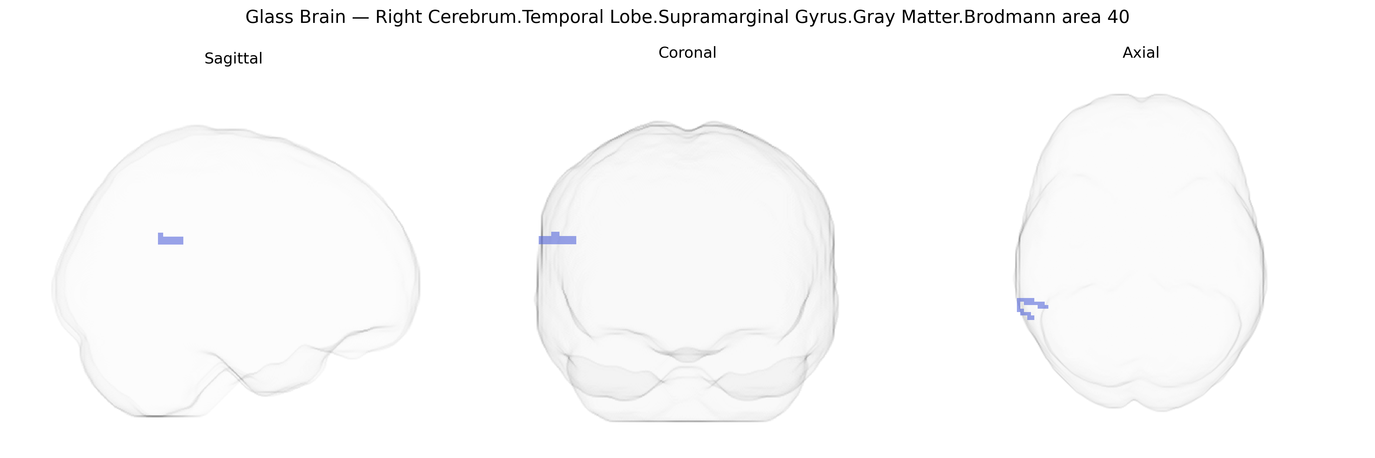 Triplanar Ghost Brain