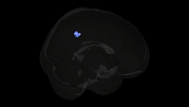 Full Brain Black