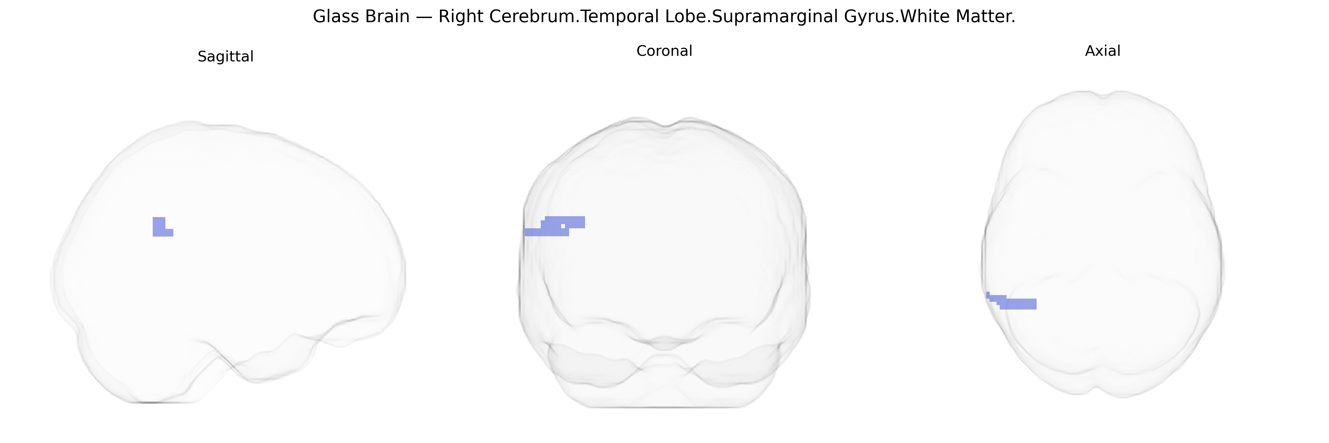 Triplanar Ghost Brain