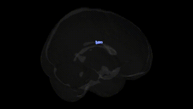 Full Brain Black