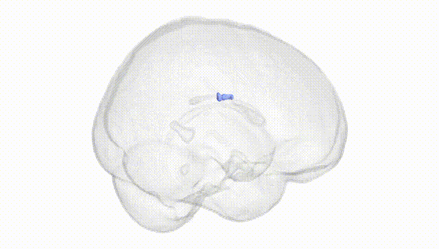 Full Brain White