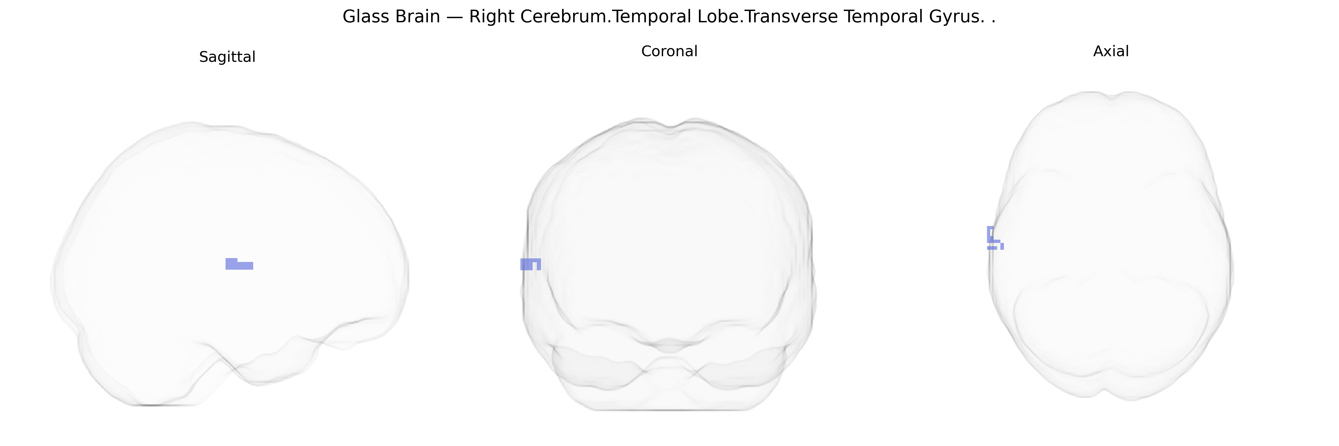 Triplanar Ghost Brain
