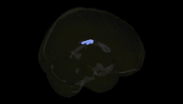 Full Brain Black