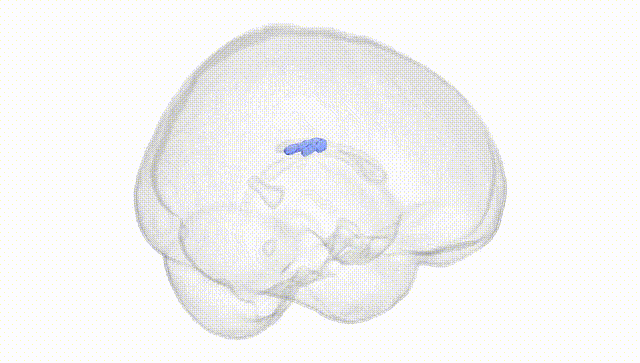 Full Brain White