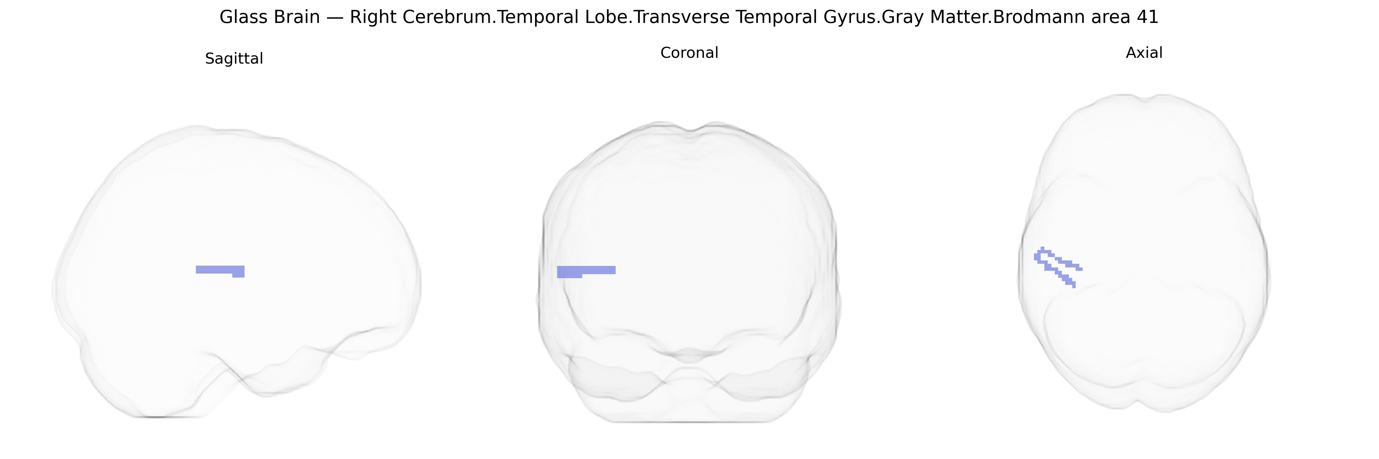 Triplanar Ghost Brain
