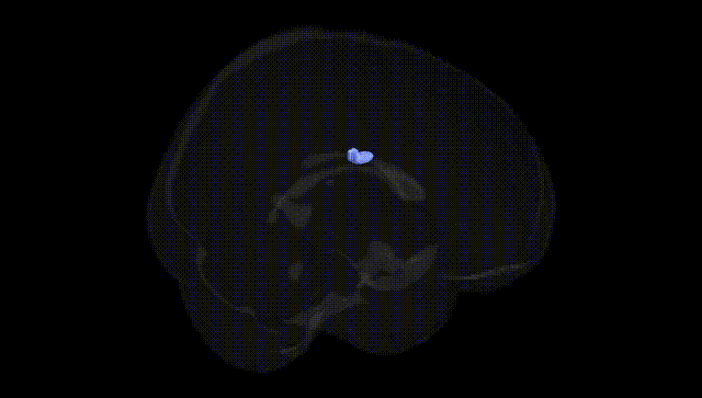 Full Brain Black