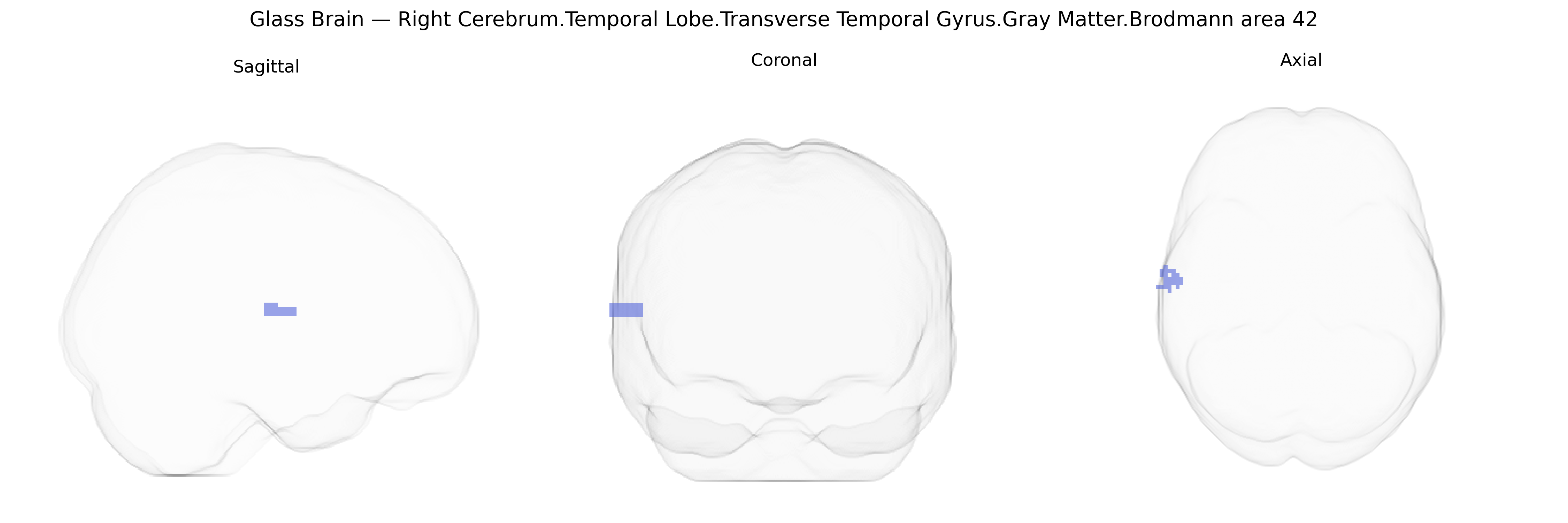 Triplanar Ghost Brain
