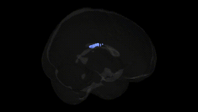 Full Brain Black