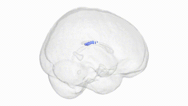 Full Brain White