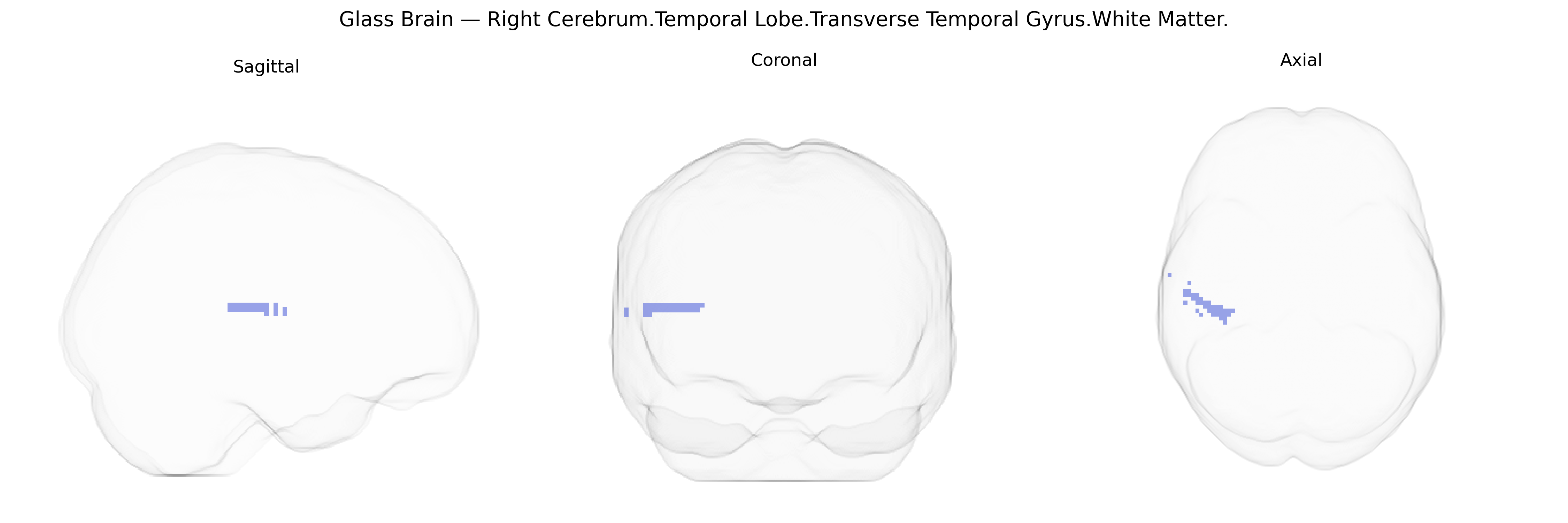 Triplanar Ghost Brain