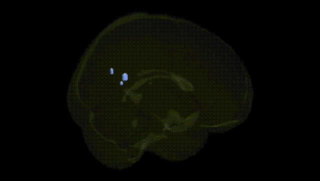 Full Brain Black