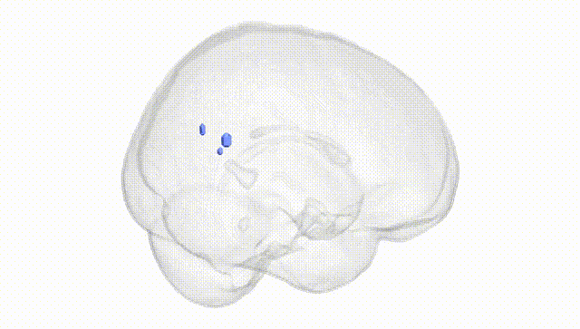 Full Brain White