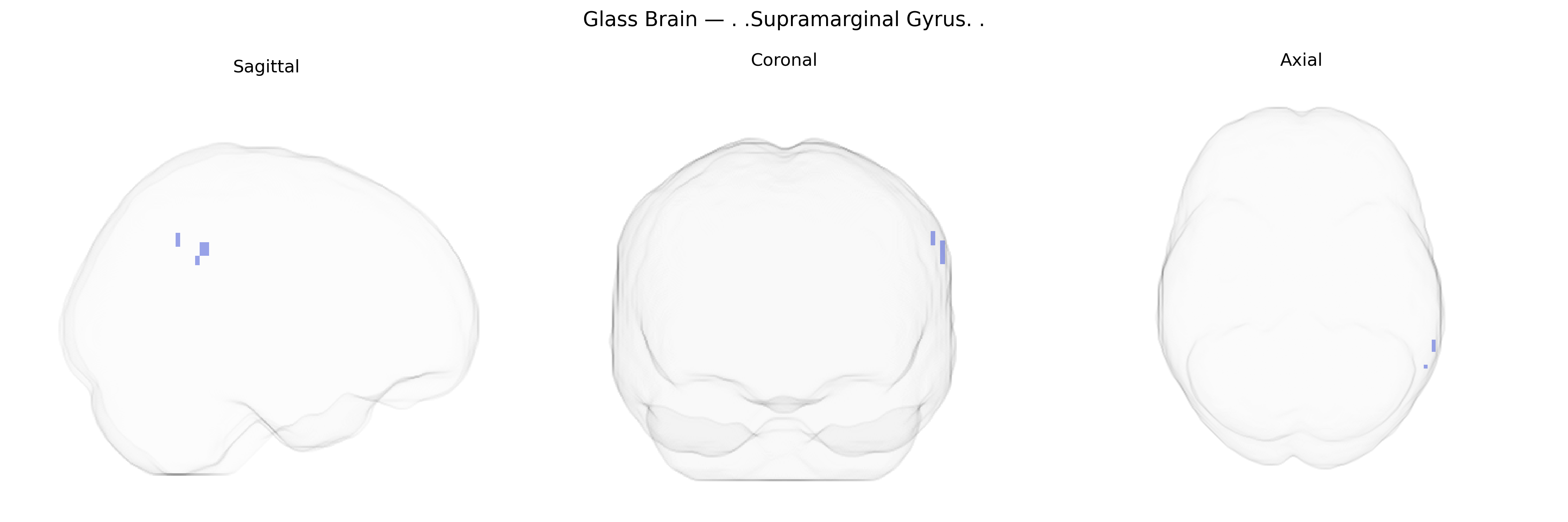 Triplanar Ghost Brain