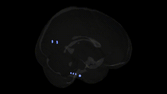 Full Brain Black