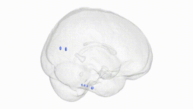 Full Brain White