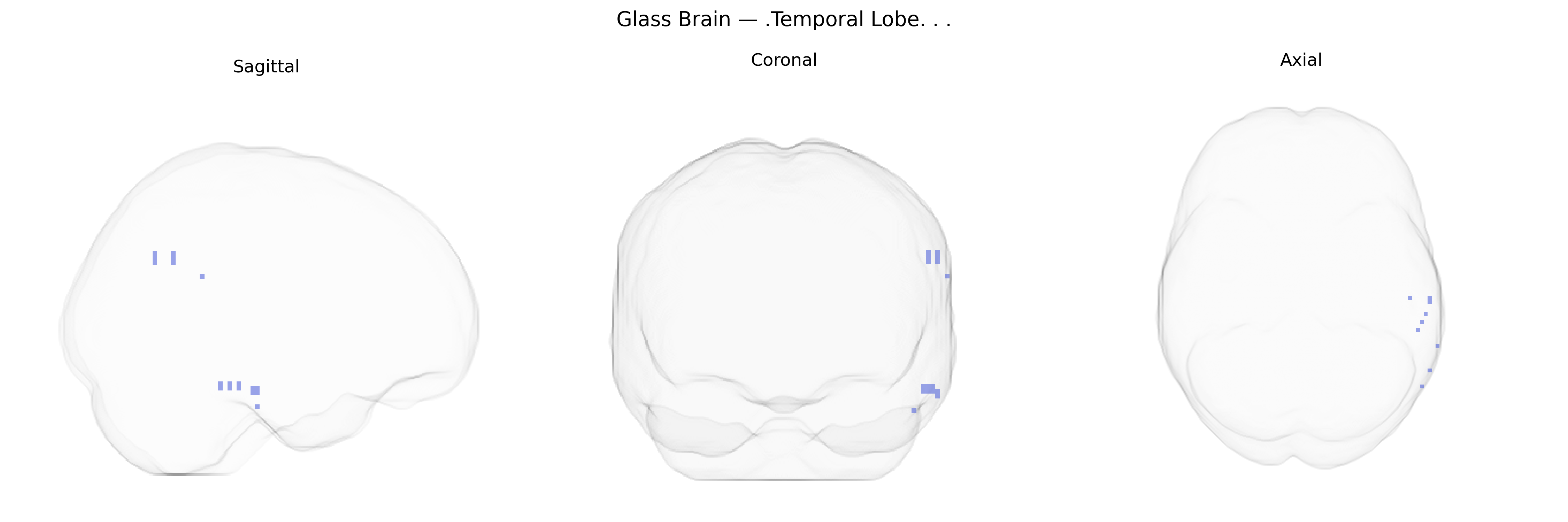 Triplanar Ghost Brain