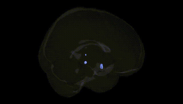 Full Brain Black