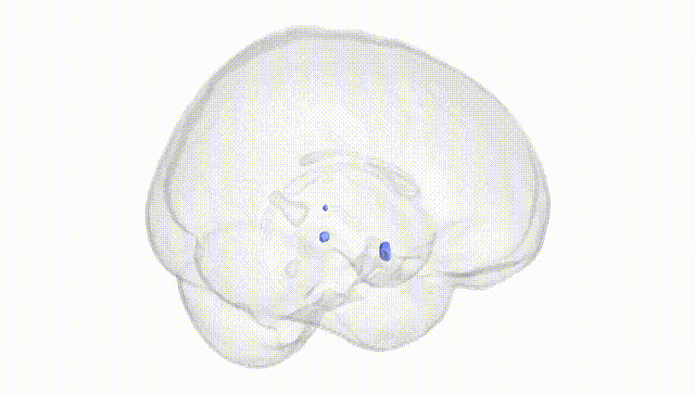 Full Brain White