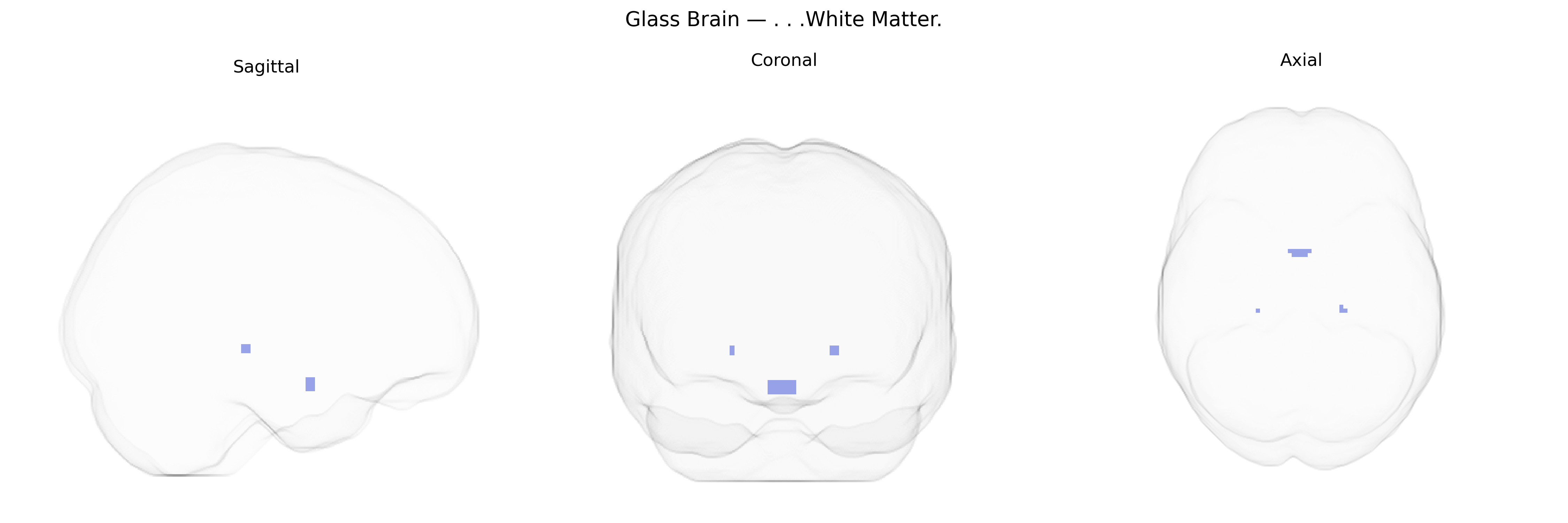 Triplanar Ghost Brain