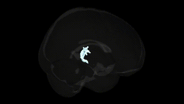 Full Brain Black