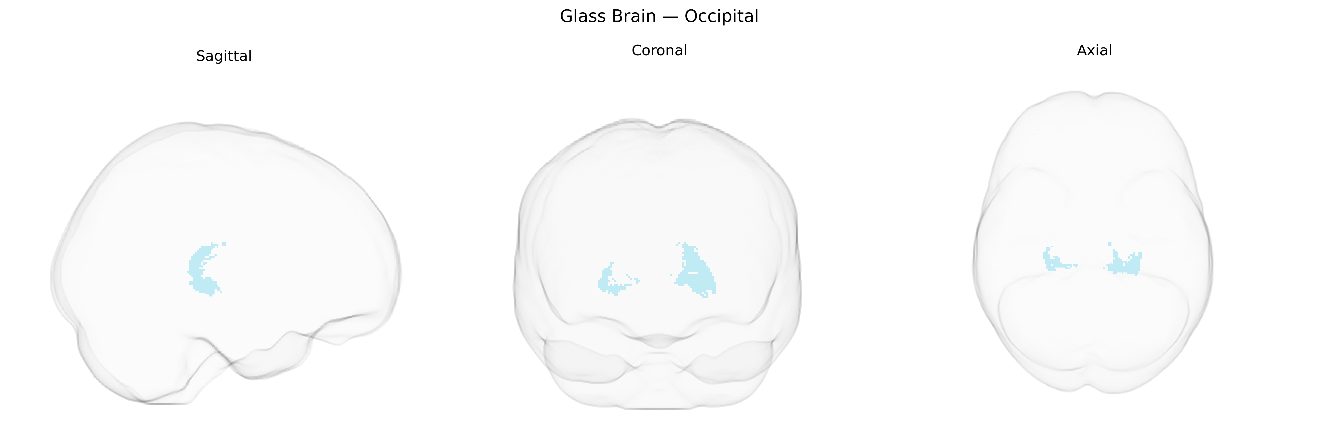 Triplanar Ghost Brain