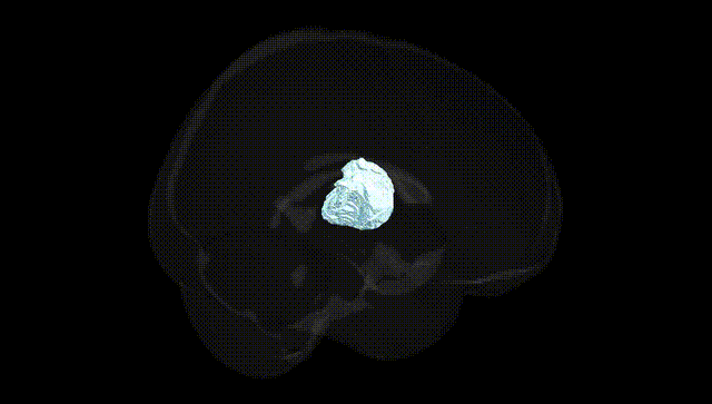 Full Brain Black