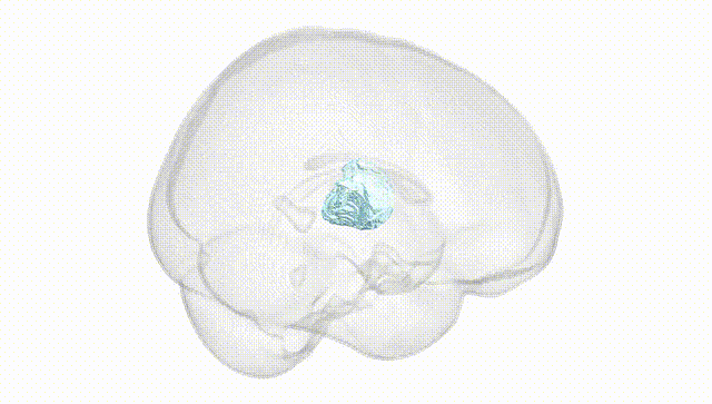 Full Brain White