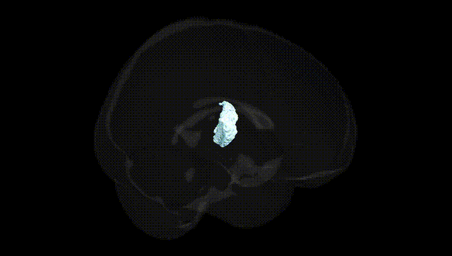 Full Brain Black
