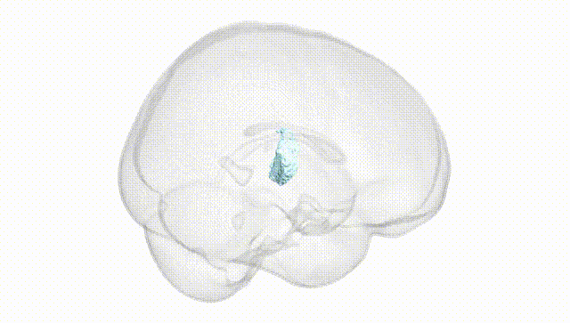 Full Brain White