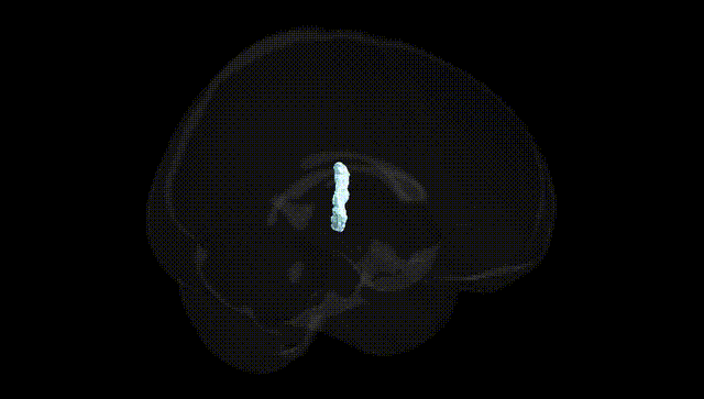 Full Brain Black
