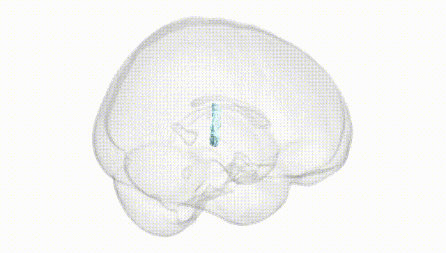 Full Brain White