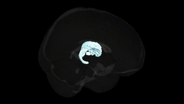 Full Brain Black