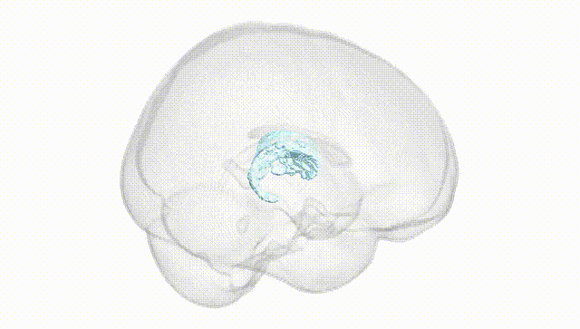 Full Brain White