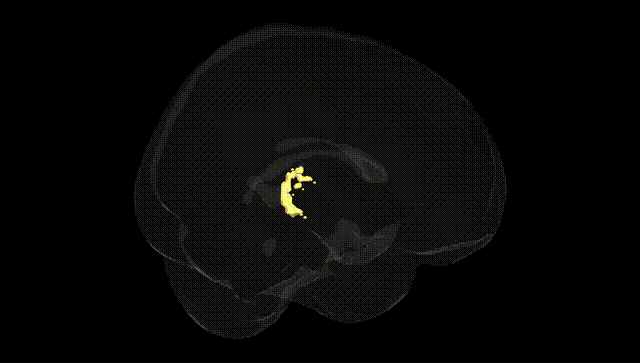Full Brain Black