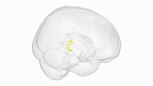 Full Brain White