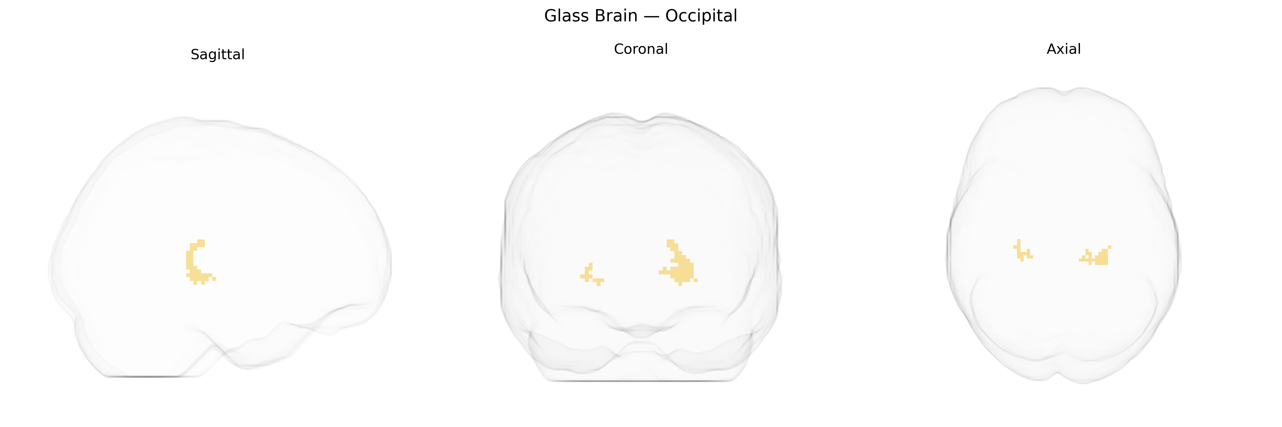 Triplanar Ghost Brain