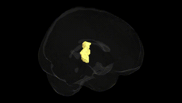 Full Brain Black