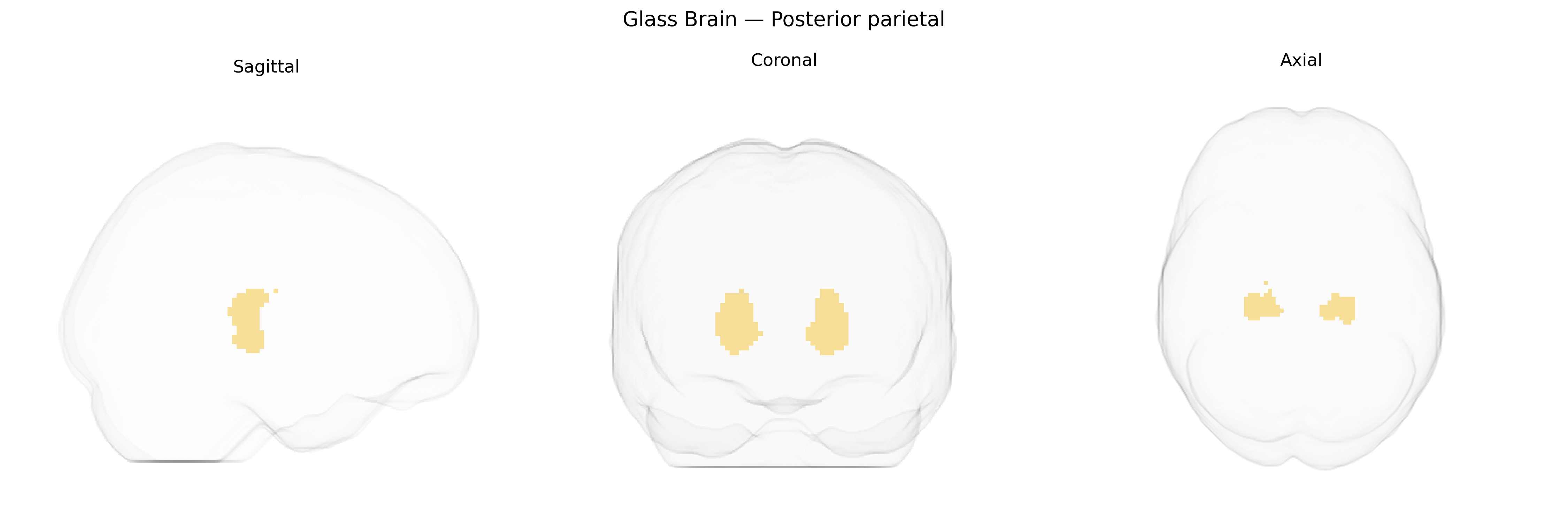 Triplanar Ghost Brain