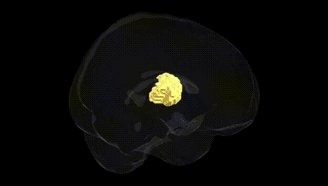 Full Brain Black