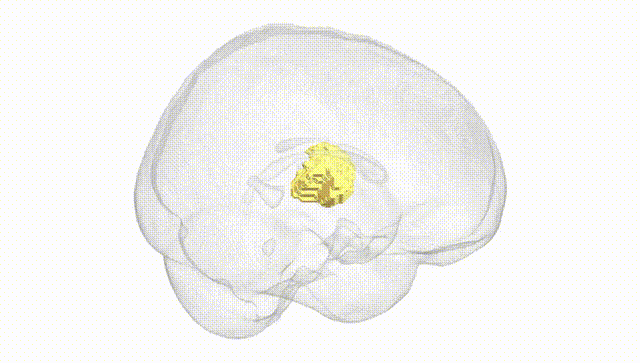 Full Brain White