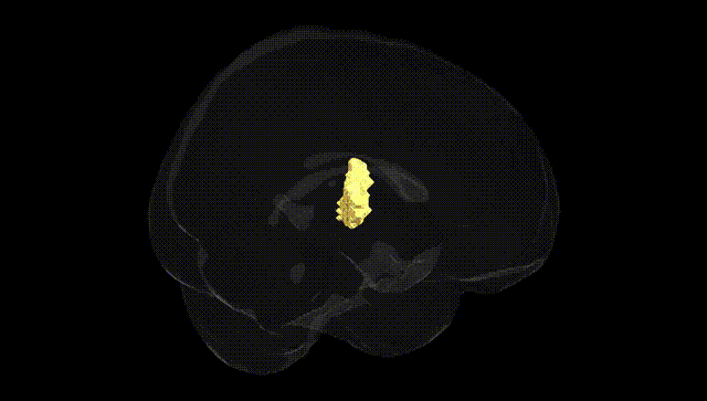Full Brain Black