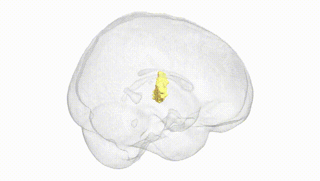 Full Brain White