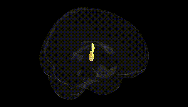 Full Brain Black