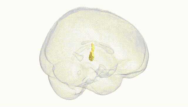 Full Brain White