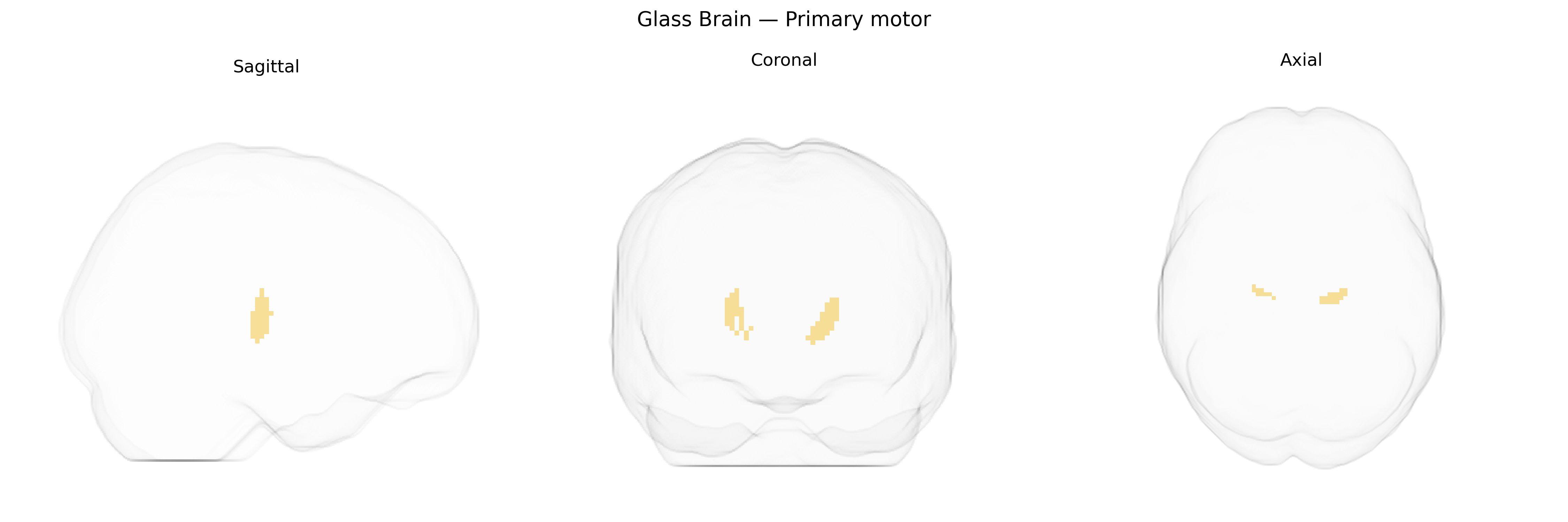 Triplanar Ghost Brain